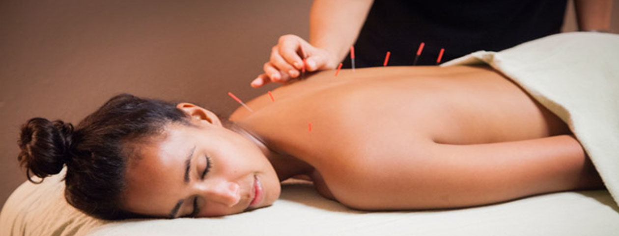 What is Acupuncture?